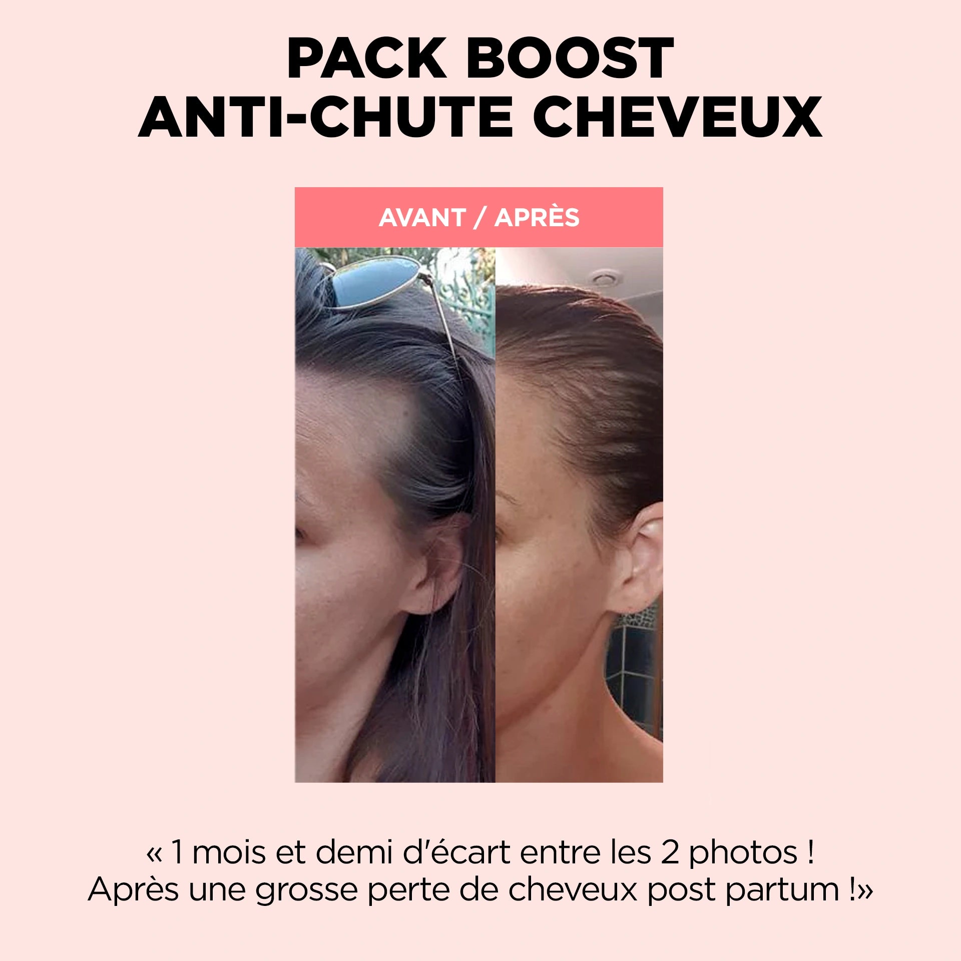 Pack Boost Anticaduta Capelli 