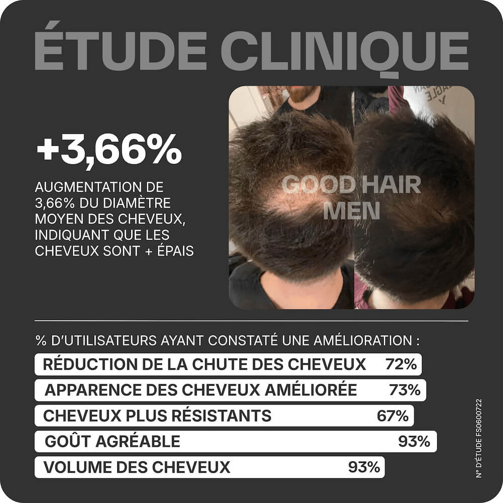 Good Hair Men Trattamento Anti-Caduta per Uomo - 6 Mesi