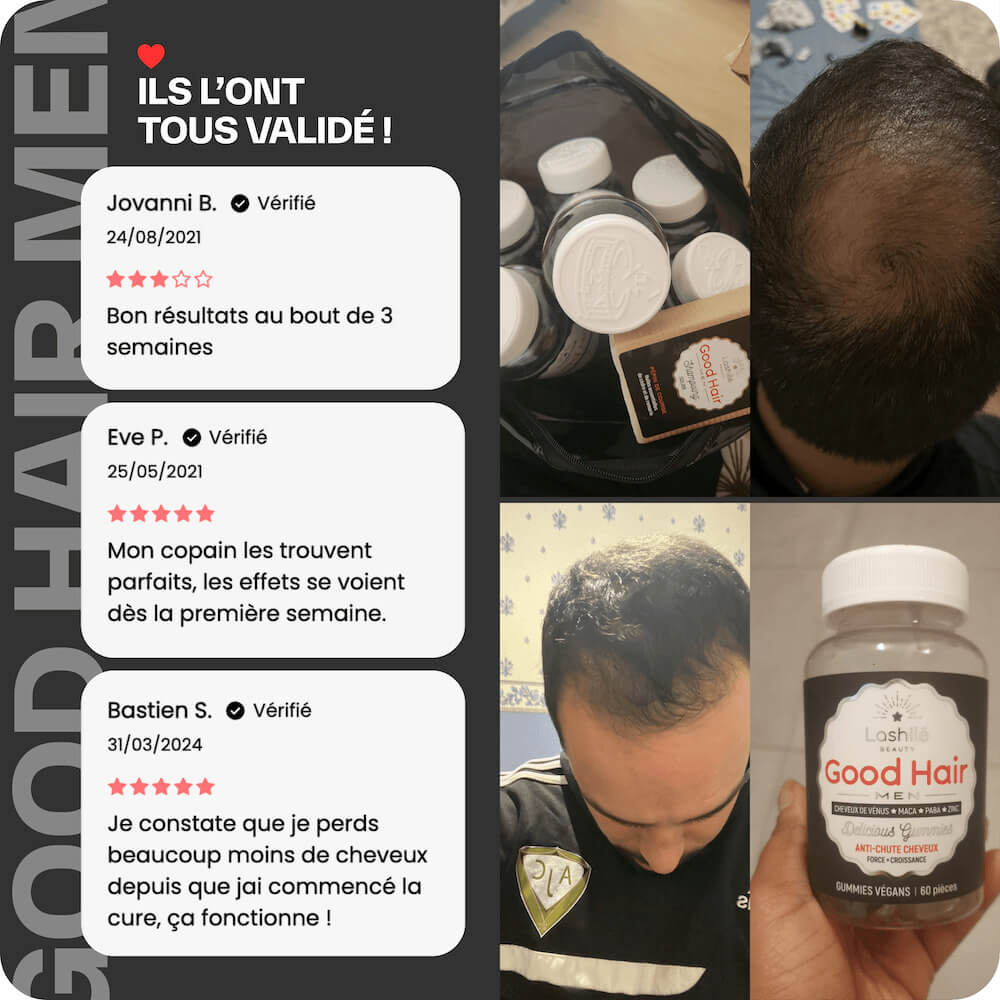 Good Hair Men Trattamento Anti-Caduta per Uomo - 6 Mesi