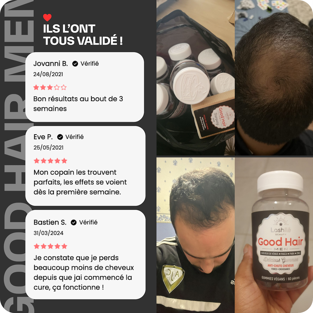 Good Hair Men Anti-Haarausfall-Behandlung für Männer – 1 Monat